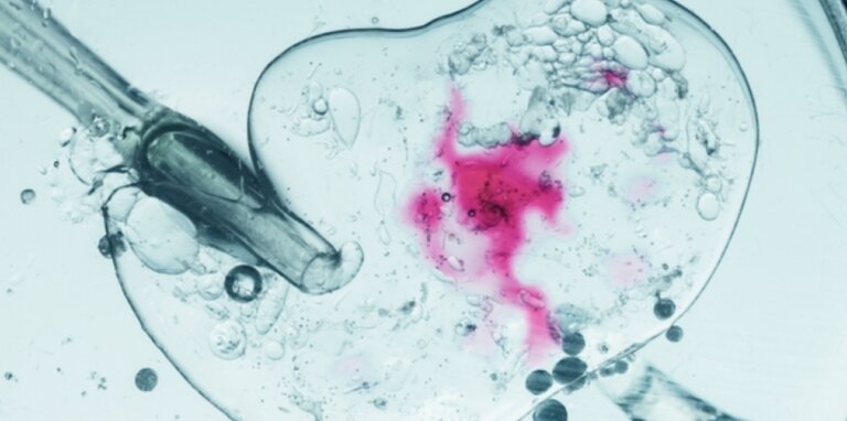 Programul de fertilizare in vitro ar putea primi buget dublu în 2026